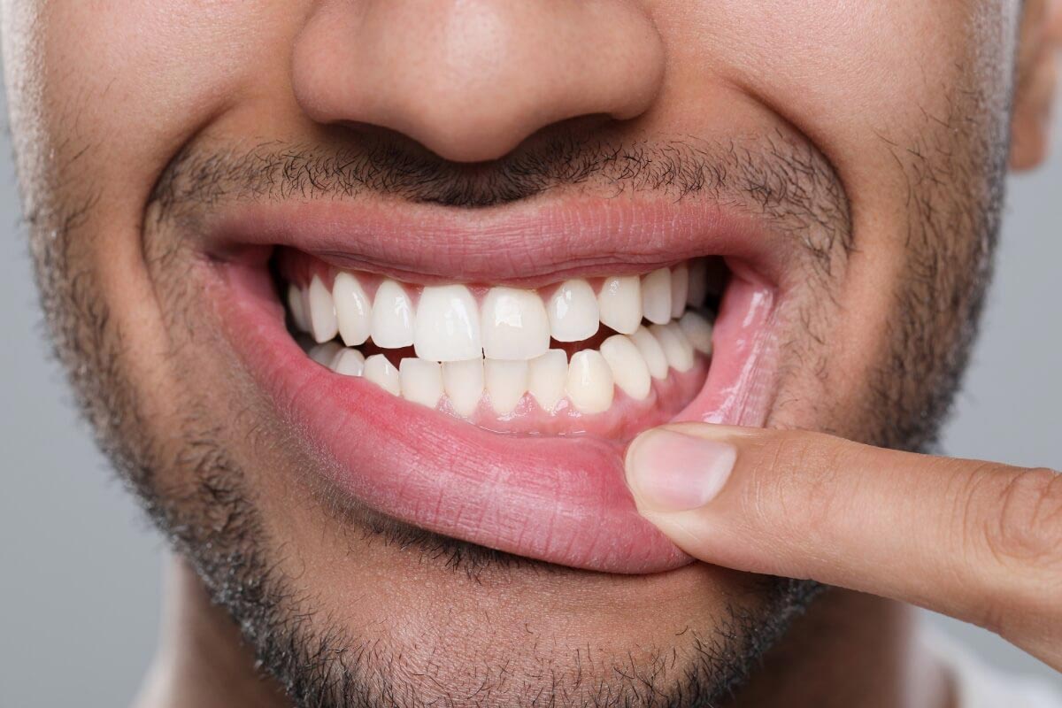 man showing off his restored gums thanks to periodontal treatment at Dynamic Dental