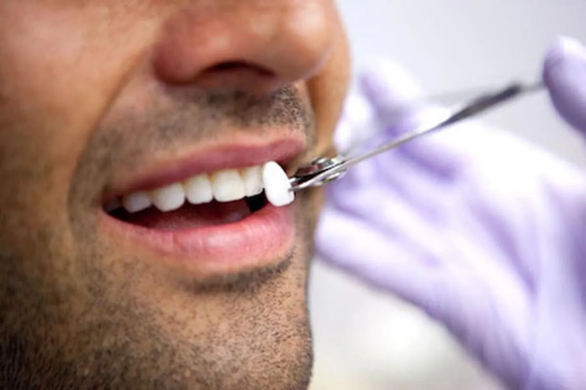 man choosing his dental veneer color at Dynamic Dental in Louisville, KY